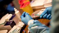 Hände in blauen Handschuhen ziehen eine Spritze auf