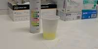 Becher mit Flüssigkeit auf Tisch. Test der Flüssigkeit auf Drogen. 