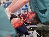 Eine Frau, die eine verletzte Person spielt, liegt bei einer Übung auf einer Trage und wird behandelt.